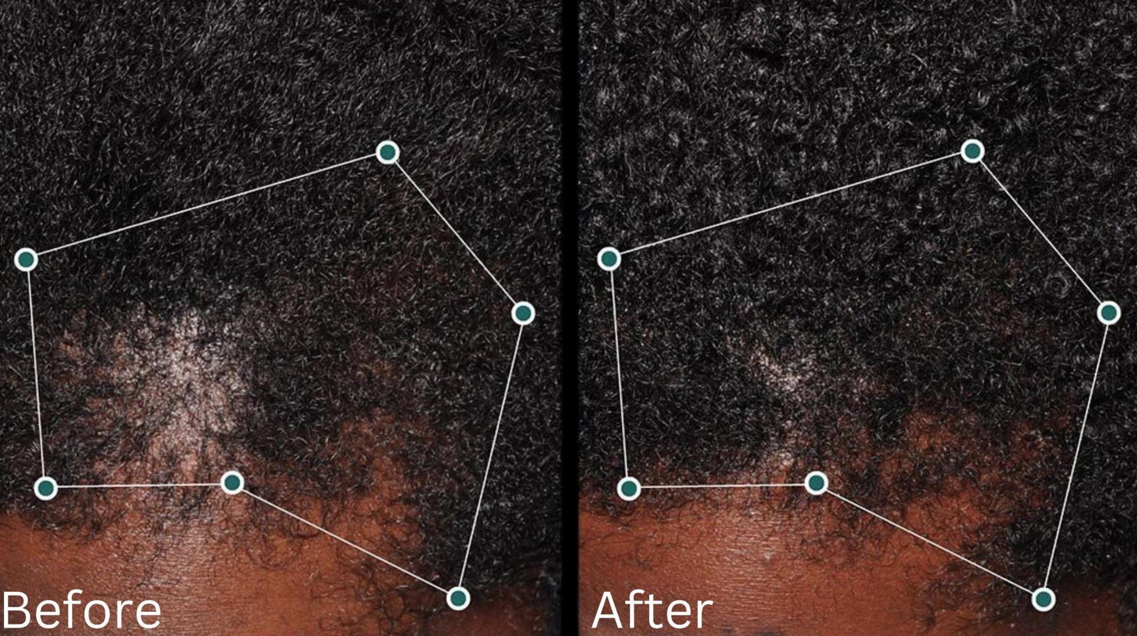 Before & After Hair Growth & Health Case 186 View 1 View in Santa Rosa, California
