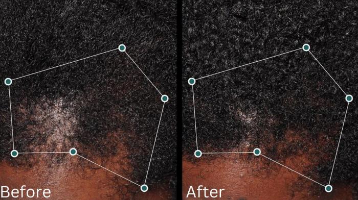 Before & After Hair Growth & Health Case 186 View 1 View in Santa Rosa, California