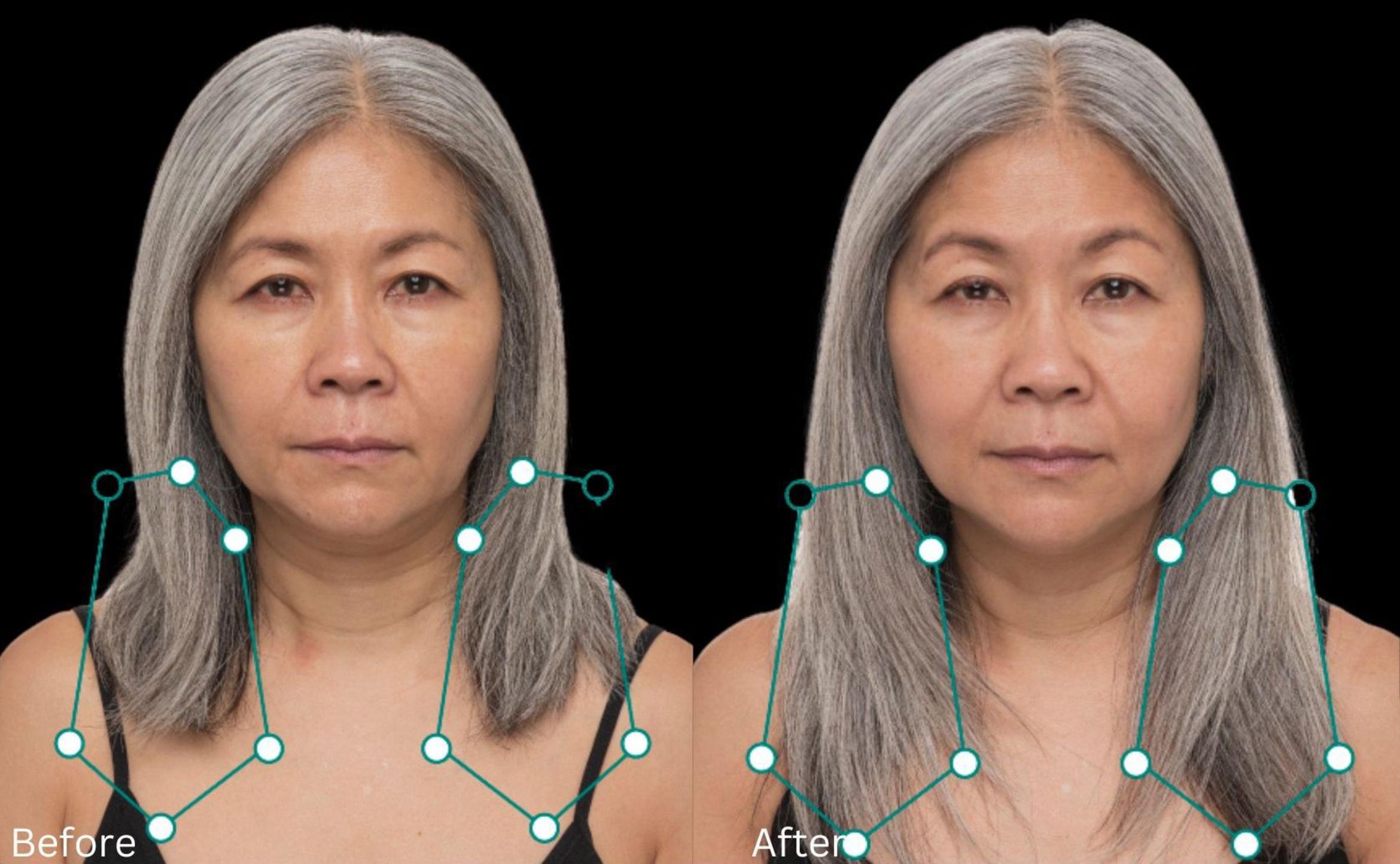 Before & After Hair Growth & Health Case 261 View 1 View in Santa Rosa, California