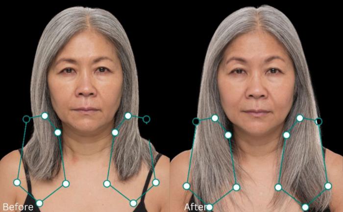 Before & After Hair Growth & Health Case 261 View 1 View in Santa Rosa, California