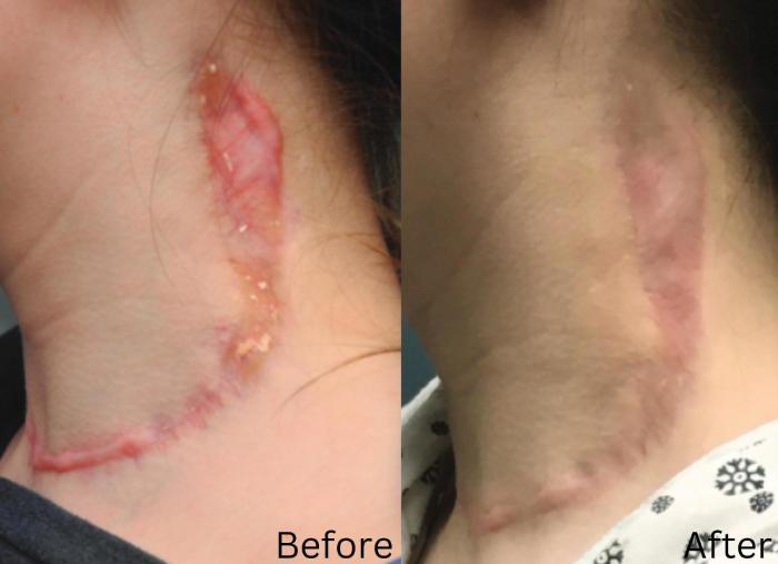 Before & After IntraCel Case 192 View 1 View in Santa Rosa, California