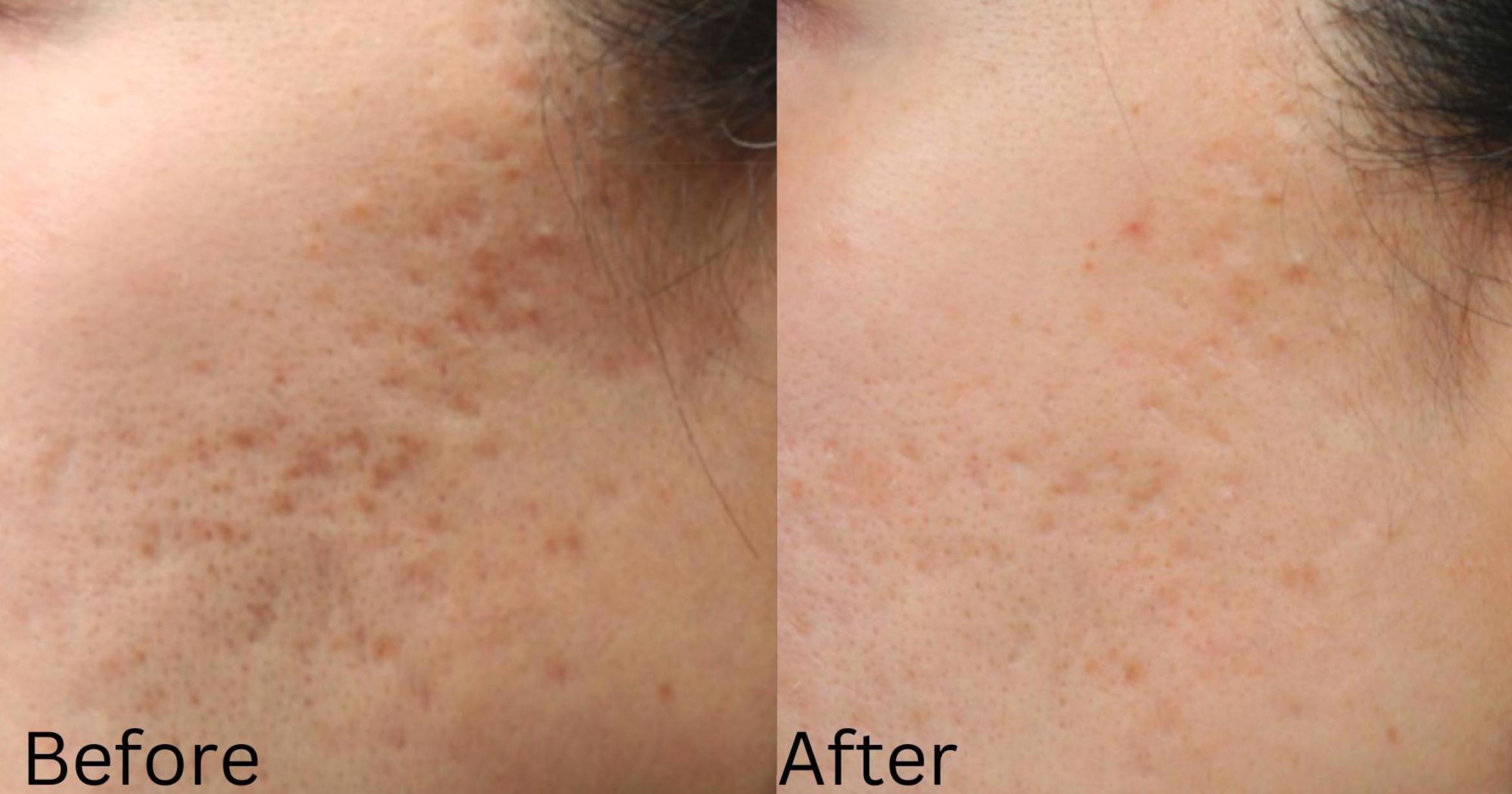 Before & After IntraCel Case 195 View 1 View in Santa Rosa, California