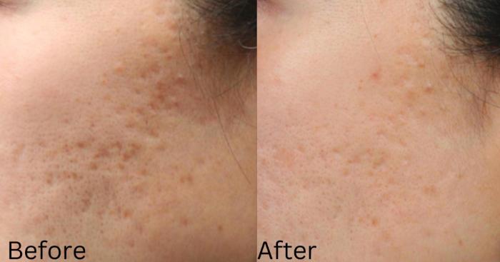 Before & After IntraCel Case 195 View 1 View in Santa Rosa, California