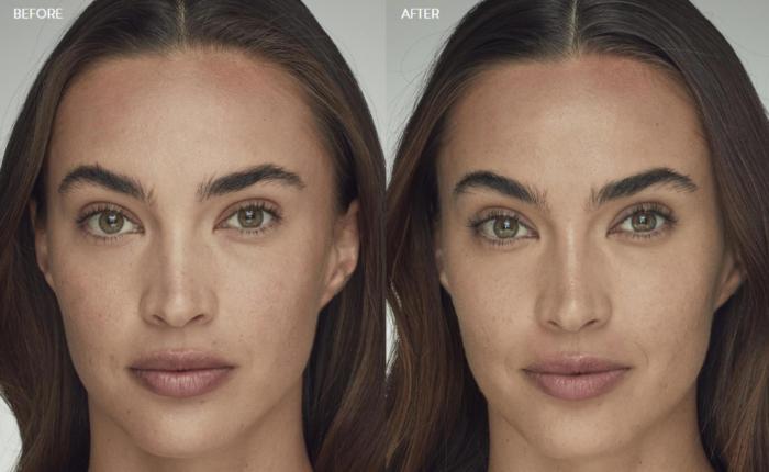 Before & After Latisse Case 358 View 1 View in Santa Rosa, California