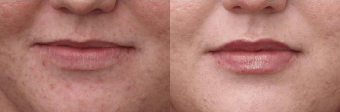 Before & After RHA Collection Case 400 View 1 View in Santa Rosa, California