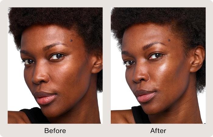Before & After SkinVive Case 210 View 1 View in Santa Rosa, California