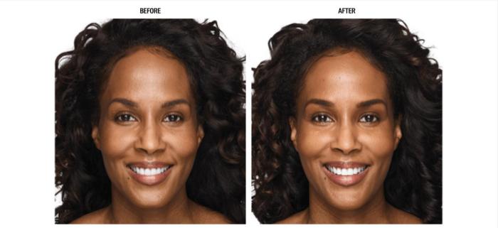 Before & After Volux Case 221 View 1 View in Santa Rosa, California