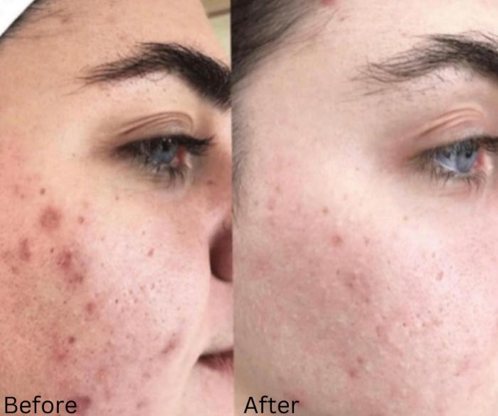 Before & After JET Plasma Case 349 View 1 View in Santa Rosa, California